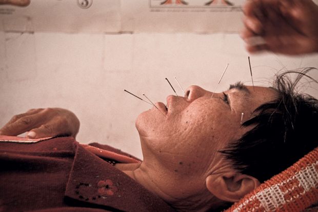 Acupuncture